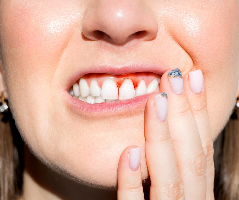 receding gums expose tooth root